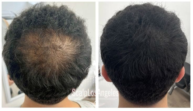 FullStrand Kerafix Pro – Instant Hair Building Fibres