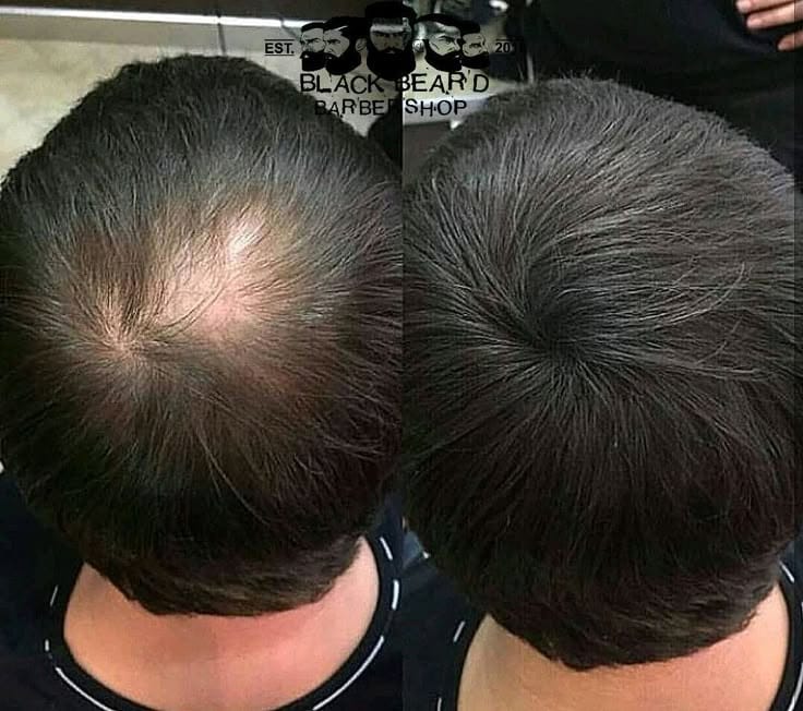 FullStrand Kerafix Pro – Instant Hair Building Fibres