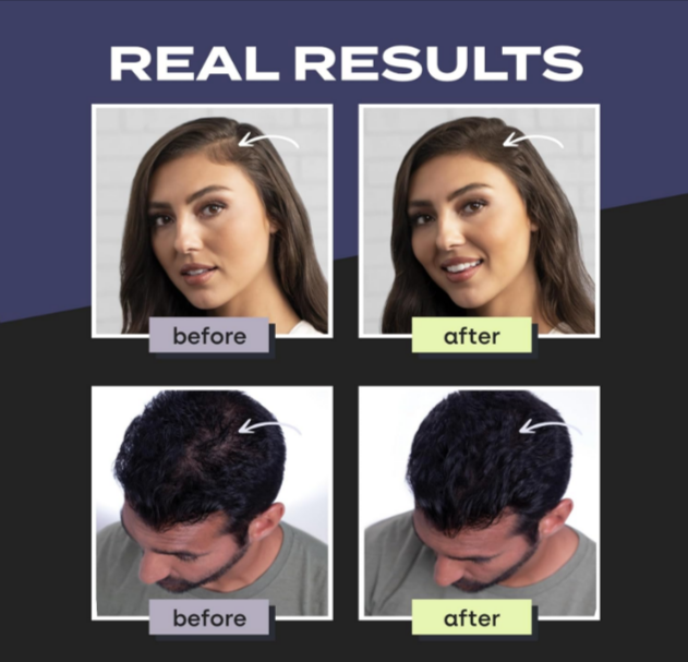 FullStrand Kerafix Pro – Instant Hair Building Fibres