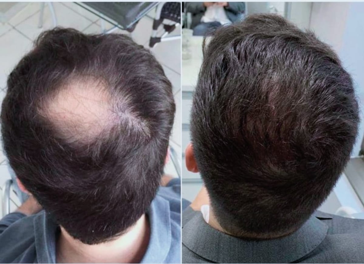 FullStrand Kerafix Pro – Instant Hair Building Fibres
